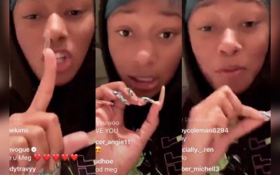 Megan Thee Stallion Finally Admits that Tory Lanez Shot Her