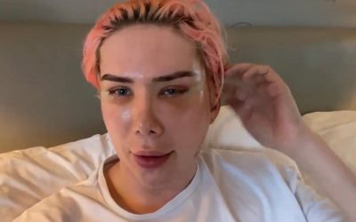 Social Media Star Oli London Gets Plastic Surgery to “Become Korean” to Look Like BTS KPop Star Park Jimin